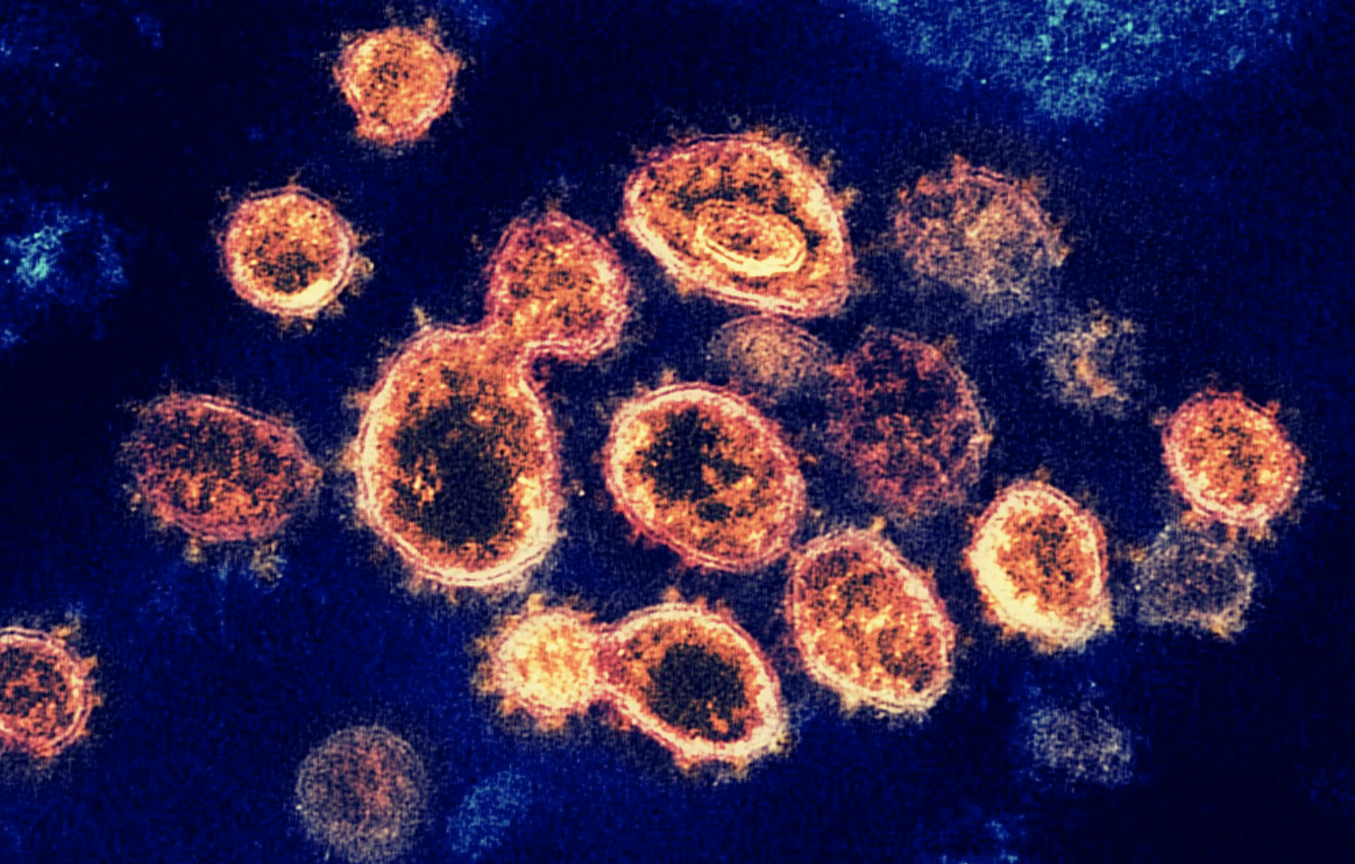 Collaboration vs. Isolation: The Coronavirus Vaccine